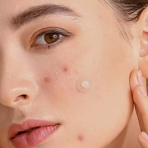 316CS Circle&Star Shape Pimple Patch Acne Cute Colourful Invisible ,Suitable for Different , Invisible Patch.