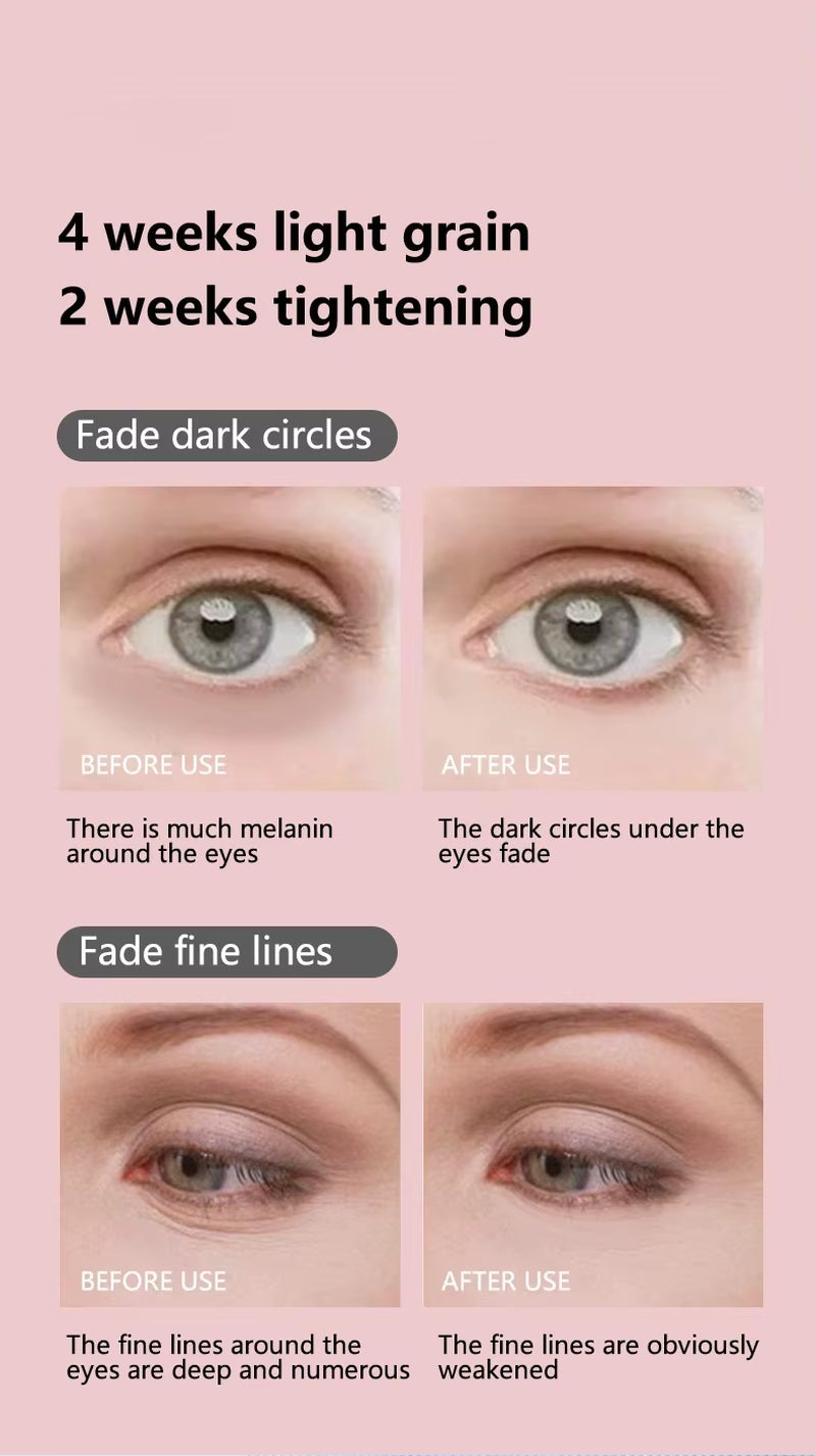 EMS Microcurrent Facial Lifter - Red Light Therapy & Anti-Wrinkle Device for Eye Neck Massage, Skin Tightening