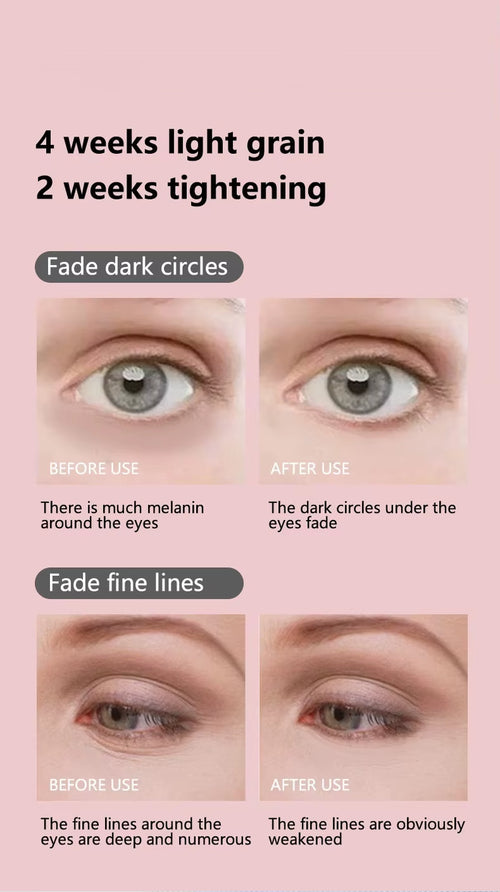 EMS Microcurrent Facial Lifter - Red Light Therapy & Anti-Wrinkle Device for Eye Neck Massage, Skin Tightening