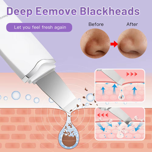 With Box Ultrasonic Skin Scrubber Vibration Face Spatula Peeling Blackhead Remover Facial Lifting Cleansing Ultrasonic Skin Care