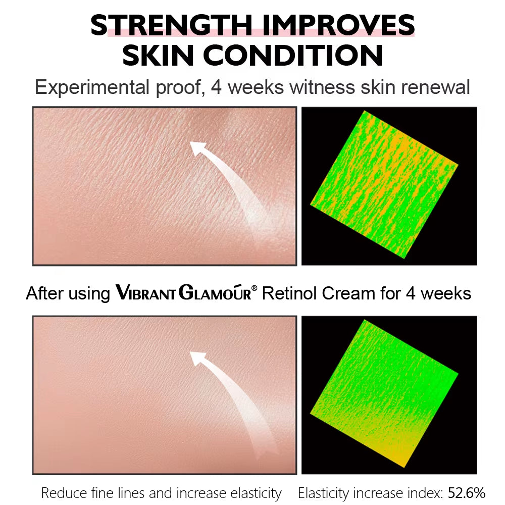 Retinol Facial Cream Anti-Aging Removal Wrinkle Fine Lines Repair Skin Barrier Whitening Brightening Moisturizing Face Cream